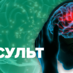 Порядок надання домедичної допомоги постраждалим при підозрі на гострий мозковий інсульт